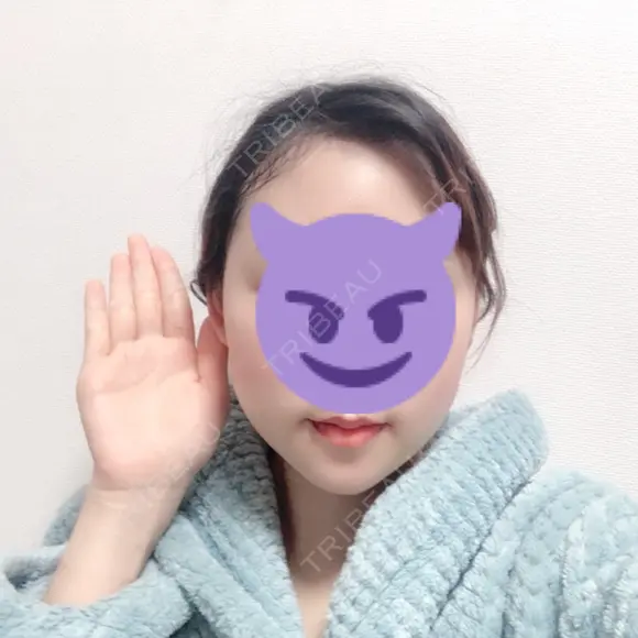 骨切り（あご） / 骨削り（エラ） ボンディ美容整形外科（旧リオン整形外科） DAY 9 メイン用