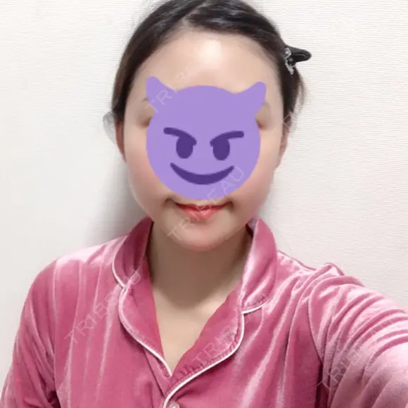 骨切り（あご） / 骨削り（エラ） ボンディ美容整形外科（旧リオン整形外科） DAY 10 メイン用