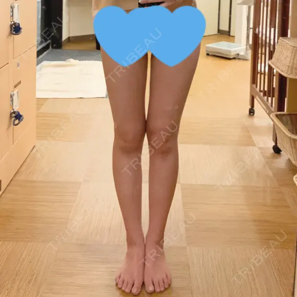 その他 GINI CLINIC（ジニクリニック） DAY 49 メイン用