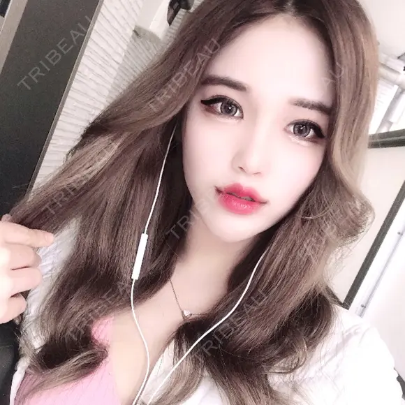 二重埋没 / 目頭切開 / 目尻切開 RG整形外科（旧リオン整形外科） DAY 98 メイン用