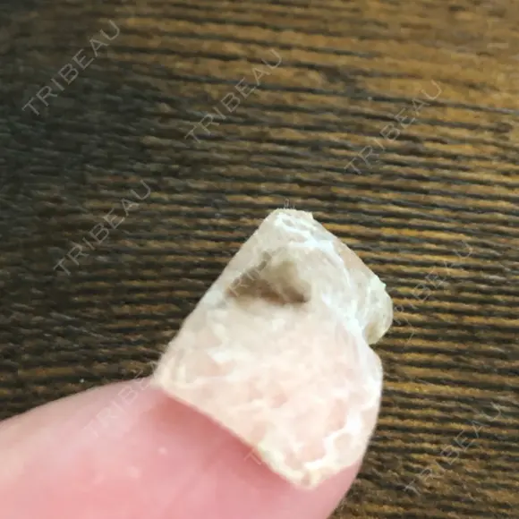 YAGレーザー 新宿美容外科クリニック 横浜院 DAY 12 メイン用