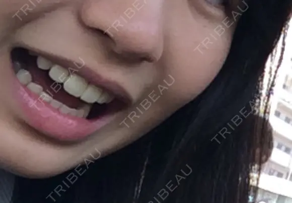 セラミック パール歯科医院 DAY 1449 メイン用