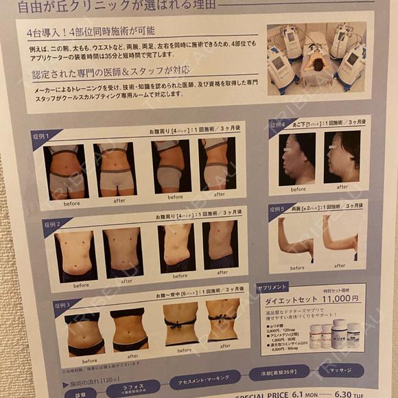 毛穴洗浄（ハイドラフェイシャルなど） 自由が丘クリニック DAY 0 メイン用