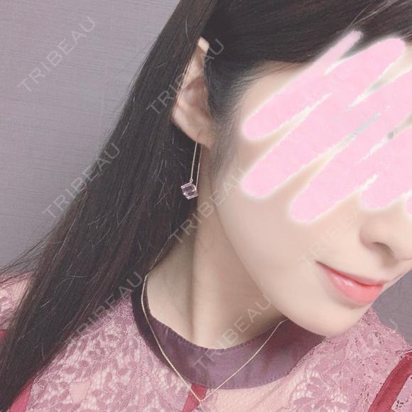 ボトックス（口角） / ハイフ（顔） Original Beauty Clinic GINZA DAY 0 メイン用