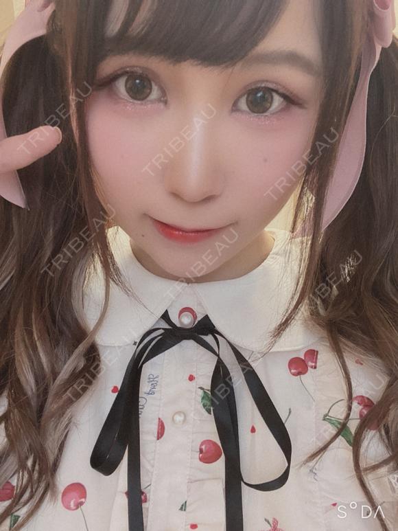 眼瞼下垂（切開） ビスポーククリニック 福岡院 DAY 42 メイン用