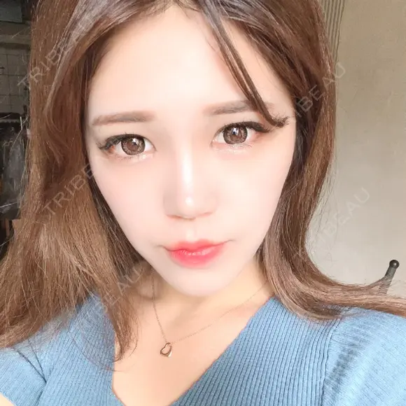 二重埋没 / 目頭切開 / 目尻切開 RG整形外科（旧リオン整形外科） DAY 194 メイン用