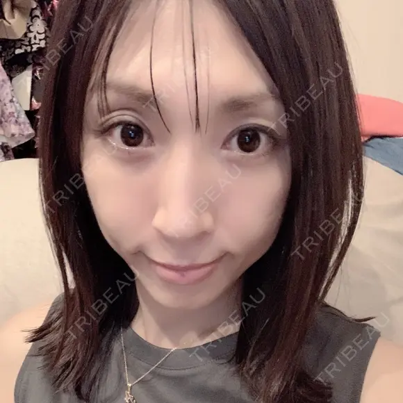 骨切り（あご） / 骨削り（エラ） / 骨削り（頬） / 脂肪注入（輪郭） バノバギ整形外科 DAY 213 メイン用