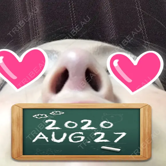 鼻尖形成（切開） / 小鼻縮小（切開） / 軟骨移植 湘南美容クリニック 船橋院 DAY 18 メイン用