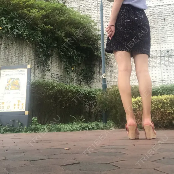 ボトックス（ふくらはぎ） TCB東京中央美容外科 中野院 AFTER メイン用