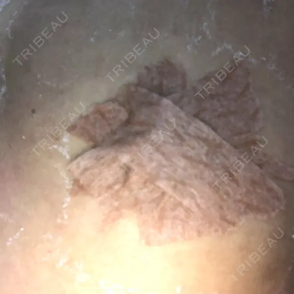 その他（胸） 三輪皮フ科形成外科 DAY 3 メイン用