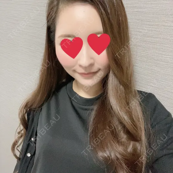 額を丸く / こめかみ形成 閉院｜プルージュ美容クリニック 赤羽院 DAY 40 メイン用