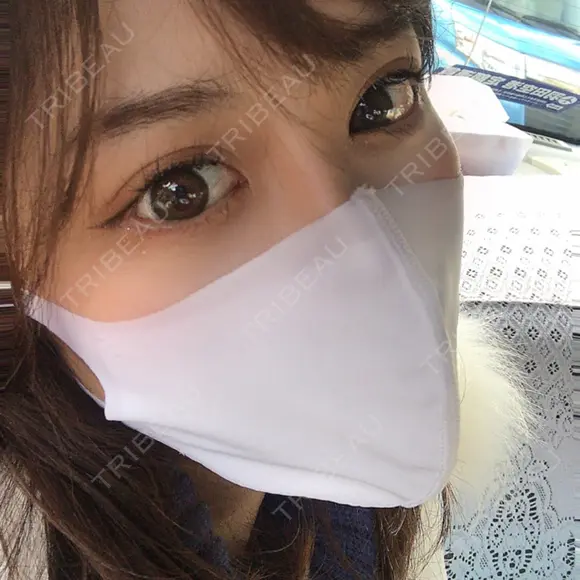 目尻切開 / タレ目形成・グラマラスライン（切開） / 目元修正 A CLINIC（エークリニック） 銀座院 DAY 6 メイン用