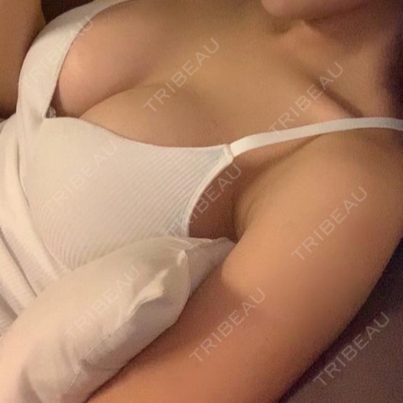 豊胸（シリコンバッグ） あつぎ美容クリニック DAY 21 メイン用