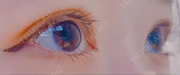 二重切開 / 目元修正 水の森美容クリニック 名古屋院 AFTER メイン用