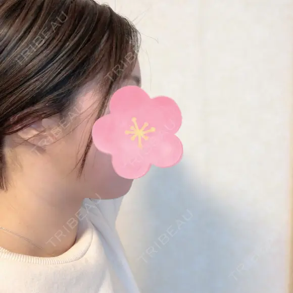 脂肪吸引（顔） 北尾クリニック DAY 25 メイン用