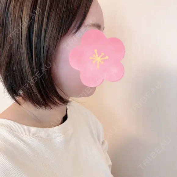 脂肪吸引（顔） 北尾クリニック DAY 31 メイン用