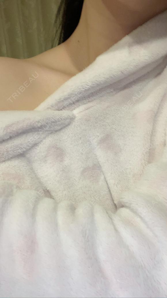 ボトックス（肩） 品川スキンクリニック 宇都宮院（※品川美容外科提携） DAY 8 メイン用