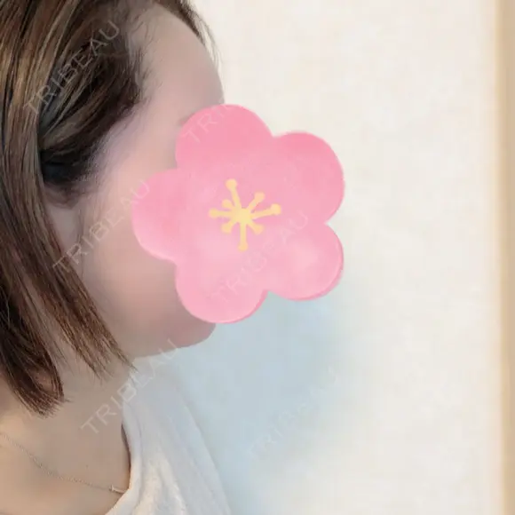 脂肪吸引（顔） 北尾クリニック DAY 38 メイン用