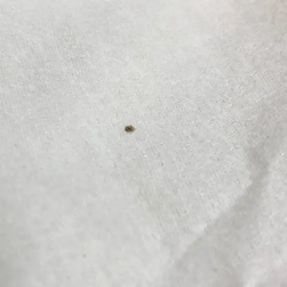 美肌レーザー / シミ取りレーザー たかはし形成外科･美容外科  DAY 4 メイン用