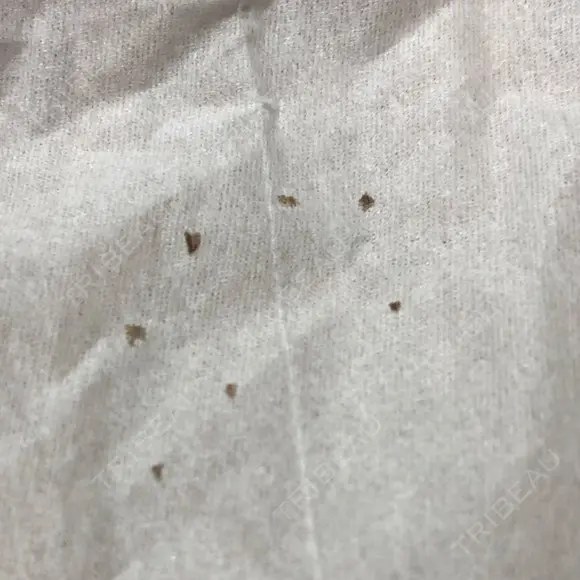 美肌レーザー / シミ取りレーザー たかはし形成外科･美容外科  DAY 5 メイン用