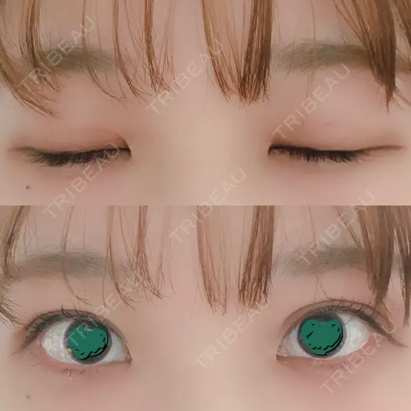 二重埋没 湘南美容クリニック 金沢院 DAY 55 メイン用