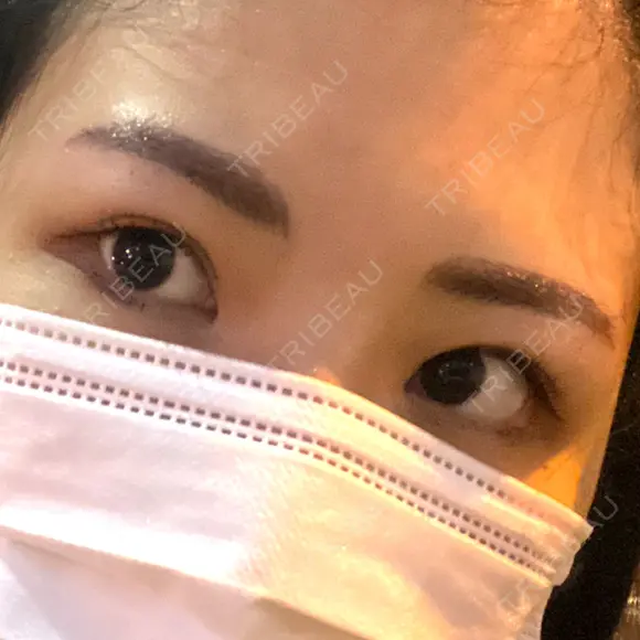 アートメイク（眉） BMC CLINIC 南青山 DAY 0 メイン用