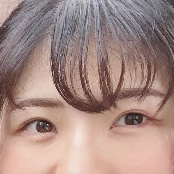 アートメイク（眉） BMC CLINIC 南青山 AFTER メイン用