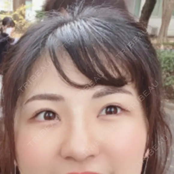 アートメイク（眉） BMC CLINIC 南青山 DAY 2 メイン用