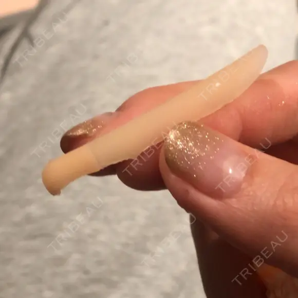 プロテーゼ除去 四谷見附クリニック DAY 0 メイン用