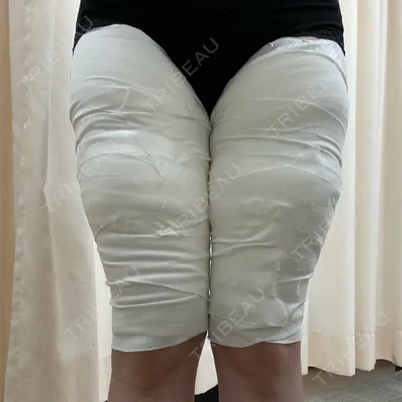 脂肪吸引（脚） / 豊胸（脂肪注入） 石倉クリニック 水戸院 DAY 0 メイン用