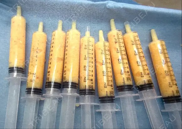 豊胸（脂肪注入） 石倉クリニック 水戸院 DAY 107 メイン用