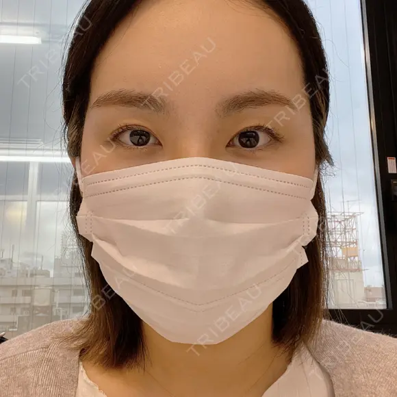 二重切開 郡山タウン形成外科クリニック DAY 120 メイン用