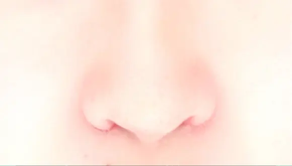 小鼻縮小（切開） / その他（鼻） みずほクリニック DAY 10 メイン用