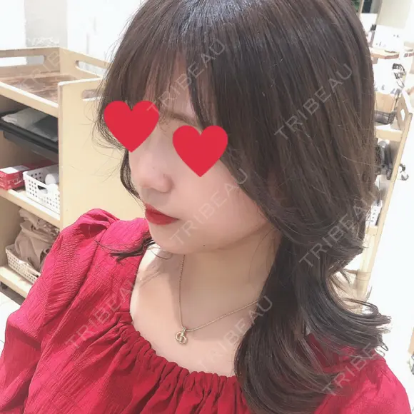 スレッドノーズ / ヒアルロン酸注入（鼻） / 脂肪溶解注射（顔） / その他（鼻） TCB東京中央美容外科 池袋西口院 DAY 17 メイン用
