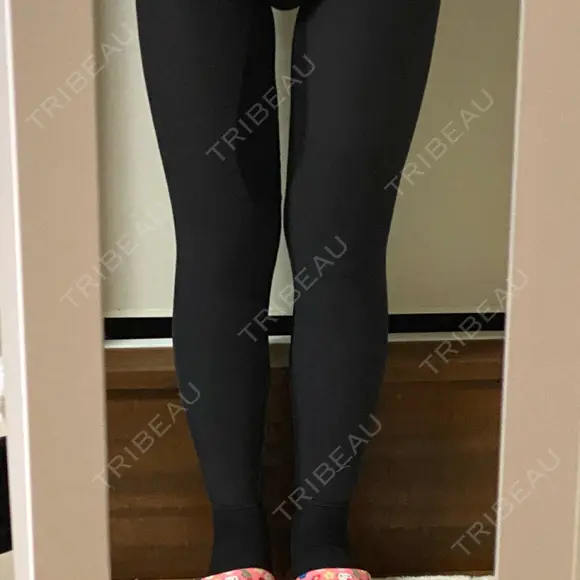 糸リフト / 脂肪吸引（顔） / 脂肪吸引（脚） / 脂肪吸引（お尻） 湘南美容クリニック 札幌院 DAY 11 メイン用