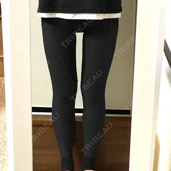 糸リフト / 脂肪吸引（顔） / 脂肪吸引（脚） / 脂肪吸引（お尻） 湘南美容クリニック 札幌院 DAY 17 メイン用