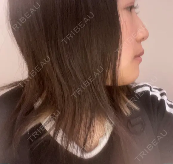 セットバック カトレア歯科・美容クリニック DAY 61 メイン用