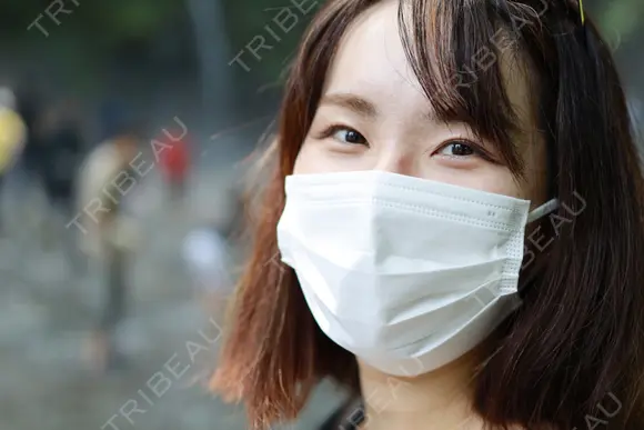 二重切開 郡山タウン形成外科クリニック DAY 169 メイン用