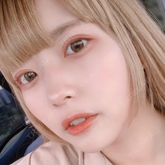 二重切開 松下皮フ形成外科 DAY 27 メイン用