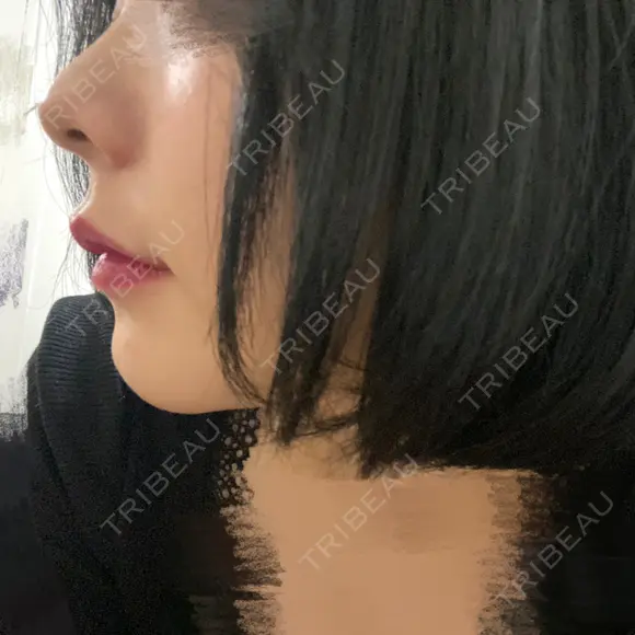 セットバック 大塚美容形成外科・歯科 大塚本院 AFTER メイン用