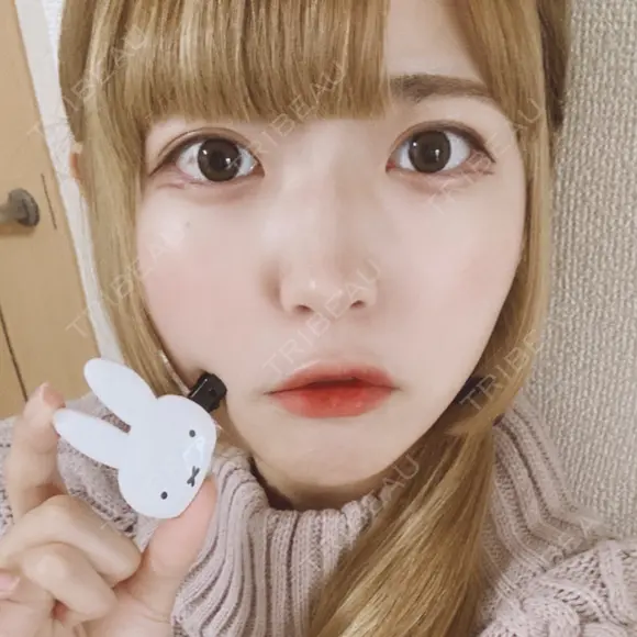 二重切開 松下皮フ形成外科 DAY 121 メイン用