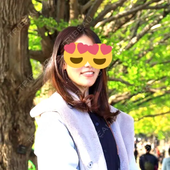 骨切り（あご） / 脂肪吸引（顔） 銀座マイアミ美容外科 DAY 190 メイン用