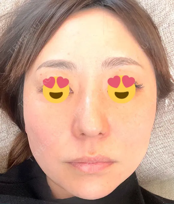 その他（肌） CHRISTINA CLINIC 銀座 DAY 2 メイン用