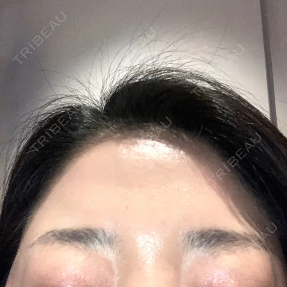 アートメイク（眉） AIM Beauty Medical Clinic DAY 18 メイン用