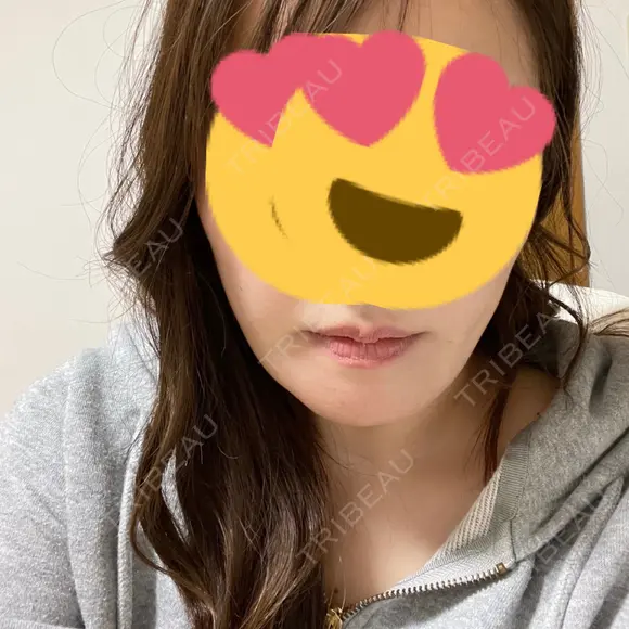 骨切り（あご） ヤスミクリニック DAY 58 メイン用