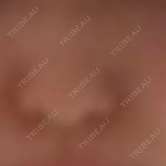 その他 TCB東京中央美容外科 新横浜院 AFTER メイン用