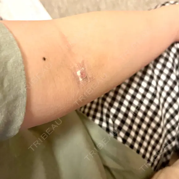 美容点滴・美容注射（ダイエット） TOKYO ACE CLINIC 心斎橋院 AFTER メイン用