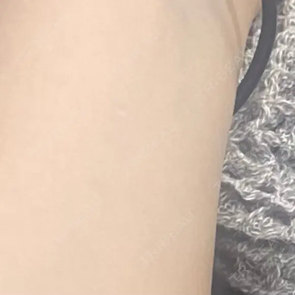白玉点滴・注射 池袋麗歯科・美容皮膚科 AFTER メイン用