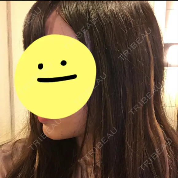 骨切り（あご） 自由が丘クリニック DAY 620 メイン用