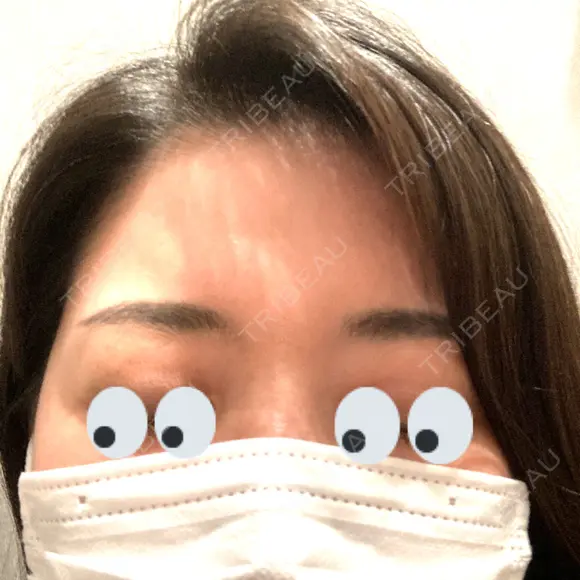 アートメイク（眉） AIM Beauty Medical Clinic AFTER メイン用